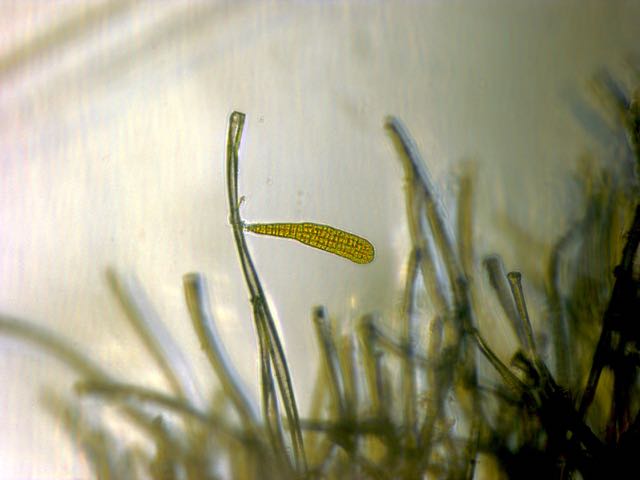 sporophyte magnified